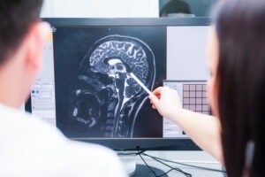 Common Brain Injury Symptoms from a Car Crash